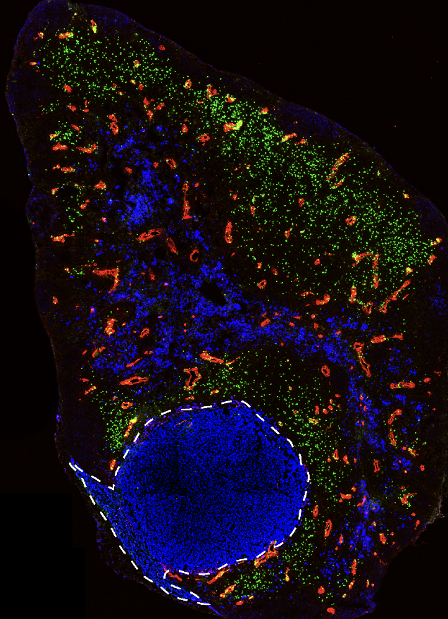 Tumor vasculature